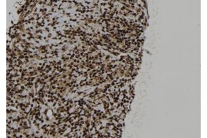 ABIN6273323 at 1/100 staining Human spleen tissue by IHC-P. (SRP54 anticorps)