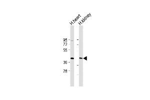 All lanes : Anti-DACL2 Antibody (Center) at 1:2000 dilution Lane 1: Human heart lysate Lane 2: Human kidney lysate Lysates/proteins at 20 μg per lane. (AADACL2 anticorps  (AA 156-182))