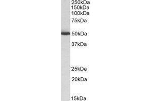 Western blot analysis: ALDH2 antibody staining of Mouse Liver lysate at 0. (ALDH2 anticorps  (Internal Region))