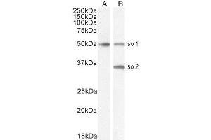 ABIN185645 (2µg/ml) staining of isoform 1 Human Brain (A) and isoform 1+2 (B) lysate (35µg protein in RIPA buffer). (Chromogranin A anticorps  (Internal Region))