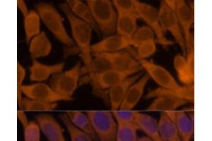 Immunofluorescence analysis of HeLa cells using NME1 Polyclonal Antibody at dilution of 1:100. (NME1 anticorps)