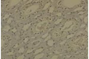 Dnmt1 Immunohistochemistry. (DNMT1 anticorps)