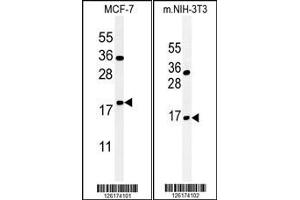 (LEFT)Western blot analysis of BTG1 Antibody in MCF-7 cell line lysates (35ug/lane). (BTG1 anticorps  (AA 92-118))
