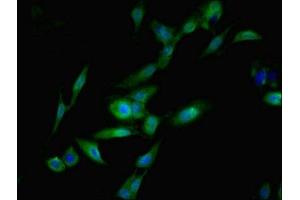 Immunofluorescent analysis of Hela cells using ABIN7169843 at dilution of 1:100 and Alexa Fluor 488-congugated AffiniPure Goat Anti-Rabbit IgG(H+L) (SGTA anticorps  (AA 1-120))