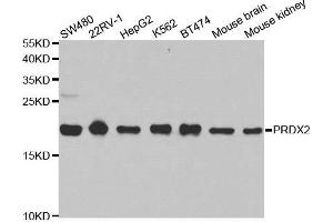 Western blot analysis of extracts of various cell lines, using PRDX2 antibody. (Peroxiredoxin 2 anticorps  (AA 1-142))