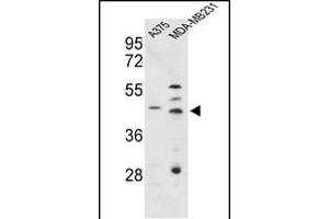Western blot analysis of CTSD Antibody (C-term) (ABIN653399 and ABIN2842857) in , MDA-M cell line lysates (35 μg/lane). (Cathepsin D anticorps  (C-Term))
