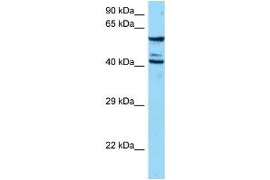 WB Suggested Anti-ESAM Antibody   Titration: 1. (ESAM anticorps  (N-Term))