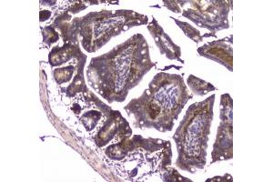 IHC testing of FFPE mouse small intestine tissue with MVP antibody at 1ug/ml. (MVP anticorps)