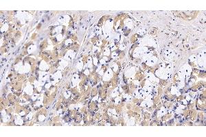 Detection of CR1 in Human Stomach Tissue using Polyclonal Antibody to Complement Receptor 1, Erythrocyte (CR1) (CD35 anticorps  (AA 1780-2039))