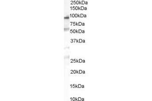 Western Blotting (WB) image for anti-Chitobiosyldiphosphodolichol beta-Mannosyltransferase (ALG1) (C-Term) antibody (ABIN2783688) (ALG1 anticorps  (C-Term))