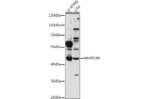 Western blot analysis of extracts of various cell lines, using NFIP antibody (ABIN7268978) at 1:1000 dilution.
