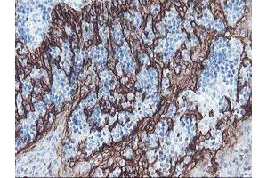 Image no. 1 for anti-Signal Recognition Particle Receptor, B Subunit (SRPRB) antibody (ABIN1501126)