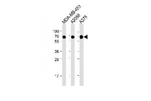 All lanes : Anti-CD63 Antibody (C-term) at 1:2000 dilution Lane 1: MDA-MB-453 whole cell lysate Lane 2:  whole cell lysate Lane 3:  whole cell lysate Lysates/proteins at 20 μg per lane. (CD63 anticorps  (C-Term))