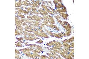 Immunohistochemistry of paraffin-embedded Rat heart using NDUF Rabbit pAb (ABIN7268807) at dilution of 1:100 (40x lens).