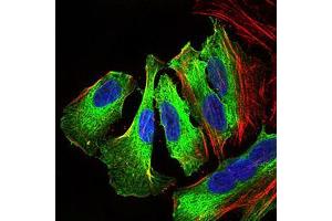 Immunofluorescence analysis of HeLa cells using MAPK14 mouse mAb (green).
