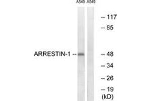 Western Blotting (WB) image for anti-Arrestin, beta 1 (ARRB1) (AA 369-418) antibody (ABIN2888645) (beta Arrestin 1 anticorps  (AA 369-418))