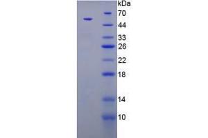Image no. 3 for Parathyroid Hormone (PTH) (AA 32-115) (Active) protein (MBP tag,His tag) (ABIN6239833)