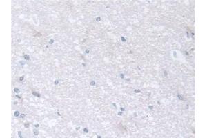 Detection of CCT2 in Human Cerebrum Tissue using Polyclonal Antibody to Chaperonin Containing TCP1, Subunit 2 (CCT2)