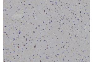 ABIN6259643 and ABIN6269296 at 1/100 staining Human heart tissue by IHC-P. (14-3-3 zeta anticorps  (C-Term))