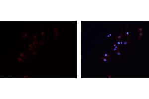 ABIN6279474 staining HEPG2 cells by IF/ICC.
