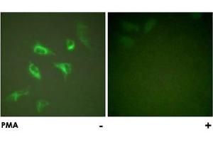 Immunofluorescence analysis of HeLa cells, treated with PMA (125 ng/mL, 30 mins), using YWHAZ polyclonal antibody . (14-3-3 zeta anticorps)