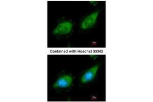 ICC/IF Image Immunofluorescence analysis of methanol-fixed HeLa, using MAP3K8, antibody at 1:200 dilution. (MAP3K8 anticorps)