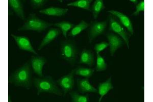 Immunofluorescence analysis of HeLa cells using TREX1 antibody. (TREX1 anticorps  (AA 1-270))