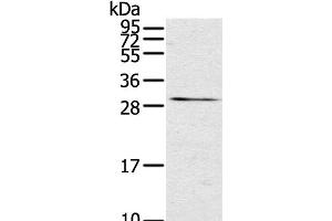 Western Blot analysis of Mouse kidney tissue using TNFSF15 Polyclonal Antibody at dilution of 1:600 (TNFSF15 anticorps)