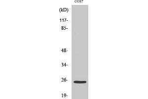 Western Blotting (WB) image for anti-Integrin Alpha7 LC (Cleaved-Glu959) antibody (ABIN5956401) (Integrin Alpha7 LC (Cleaved-Glu959) anticorps)