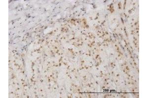 Image no. 1 for anti-Eukaryotic Translation Initiation Factor 2-alpha Kinase 2 (EIF2AK2) (AA 1-101) antibody (ABIN598901) (EIF2AK2 anticorps  (AA 1-101))