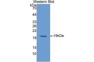 Detection of Recombinant LIFR, Rat using Polyclonal Antibody to Leukemia Inhibitory Factor Receptor (LIFR)