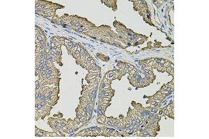 Immunohistochemistry of paraffin-embedded human prostate using SMN2 antibody. (SMN2 anticorps  (AA 1-197))