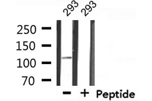 Western blot analysis of extracts from 293, using MED24 Antibody. (MED24 anticorps  (C-Term))