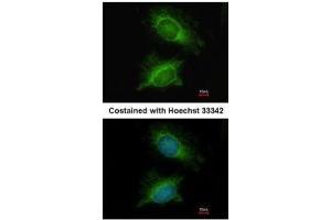 ICC/IF Image Immunofluorescence analysis of methanol-fixed HeLa, using PGM3, antibody at 1:200 dilution. (Phosphoglucomutase 3 anticorps)