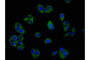 Immunofluorescence staining of HepG2 cells with ABIN7153343 at 1:266, counter-stained with DAPI.