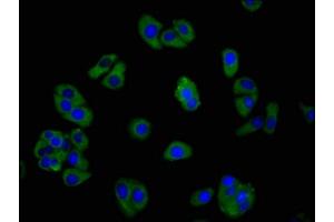 Immunofluorescence staining of HepG2 cells with ABIN7153343 at 1:266, counter-stained with DAPI. (GPR39 anticorps  (AA 345-453))