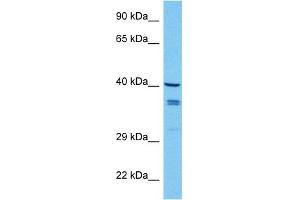 Host:  Mouse  Target Name:  WNT7B  Sample Tissue:  Mouse Spleen  Antibody Dilution:  1ug/ml (WNT7B anticorps  (Middle Region))
