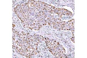 IHC analysis of PPA2 using anti-PPA2 antibody (ABIN6719431). (PPA2 anticorps  (AA 33-334))