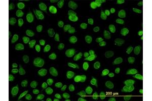 Immunofluorescence of monoclonal antibody to EMD on HeLa cell. (Emerin anticorps  (AA 1-110))