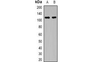 Western blot analysis of MYPT1 (pT696) expression in HEK293T PMA-treated (A), HEK293T UV-treated (B) whole cell lysates. (PPP1R12A anticorps  (pSer696))