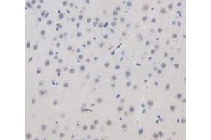 IHC-P analysis of Mouse Tissue, with DAB staining. (GAD anticorps  (AA 1-97))
