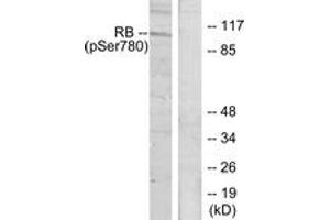Western blot analysis of extracts from K562 cells treated with serum 10%, using Retinoblastoma (Phospho-Ser780) Antibody. (Retinoblastoma Protein (Rb) anticorps  (pSer780))