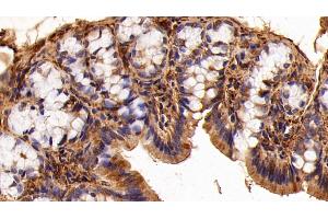 Detection of GAL1 in Rat Colon Tissue using Polyclonal Antibody to Galectin 1 (GAL1)