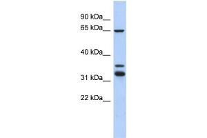 WB Suggested Anti-S100PBP Antibody Titration: 0. (S100PBP anticorps  (Middle Region))