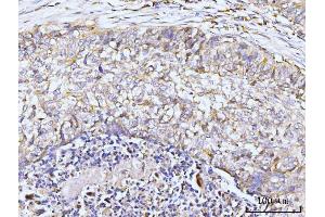 IHC analysis of GIT1 using anti-GIT1 antibody (ABIN7601683). (GIT1 anticorps  (AA 415-736))