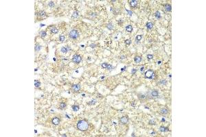 Immunohistochemistry of paraffin-embedded human liver injury using ATP5A1 antibody.