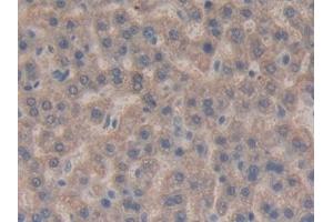 Detection of CTGF in Rat Liver Tissue using Monoclonal Antibody to Connective Tissue Growth Factor (CTGF)