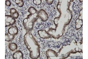 Immunoperoxidase of monoclonal antibody to CHFR on formalin-fixed paraffin-embedded human small Intestine.