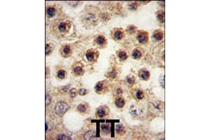 Formalin-fixed and paraffin-embedded human testis tissue reacted with YBX2 polyclonal antibody  , which was peroxidase-conjugated to the secondary antibody, followed by DAB staining. (YBX2 anticorps  (C-Term))