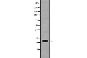 Western blot analysis SFT2D3 using HT-29 whole cell lysates (SFT2D3 anticorps  (N-Term))